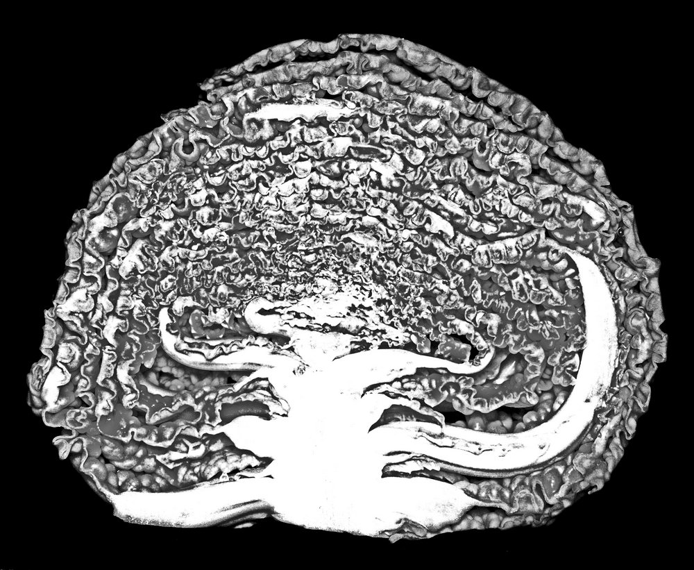 Cabbage