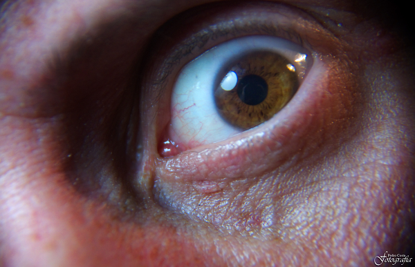 Eye for an Eye